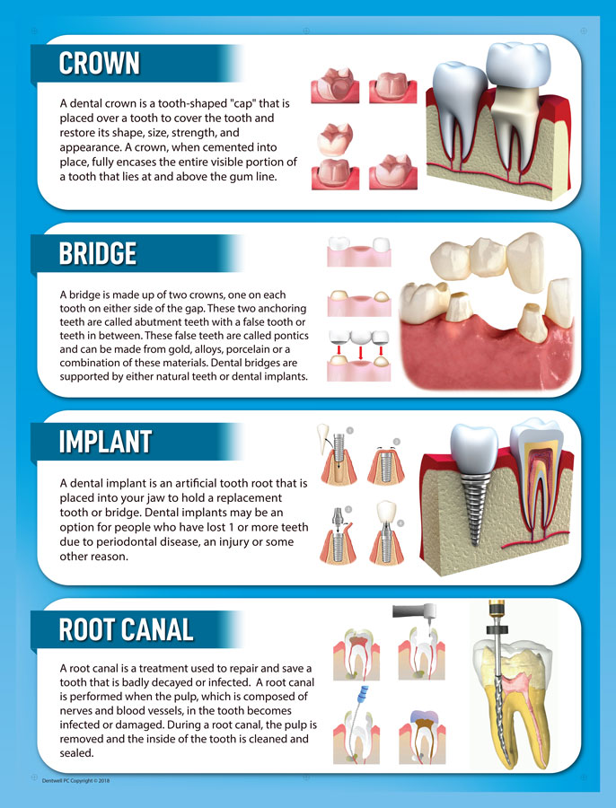 Dental Crown Procedure