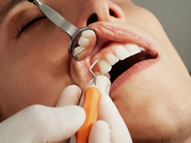 Read more about the article best dental clinic in faridabad