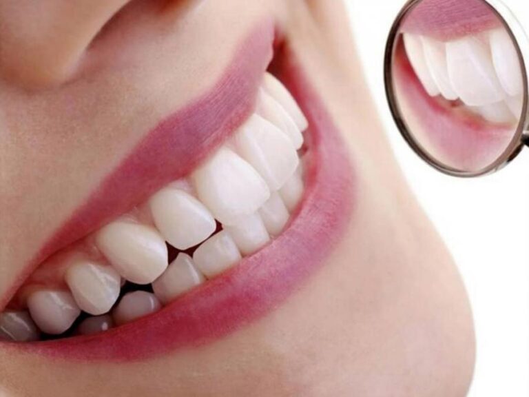 Cosmetic Dentistry